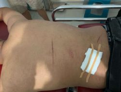 Pesta Miras Depan SMAN 3 Polewali Berujung Petaka, Seorang Terkena Sabetan Celurit